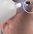 Electric Pore Cleaner & Facial Vacuum