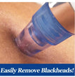 Electric Pore Cleaner & Facial Vacuum