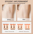 Babyverse - Digital IPL Hair Removal Device GIBBS